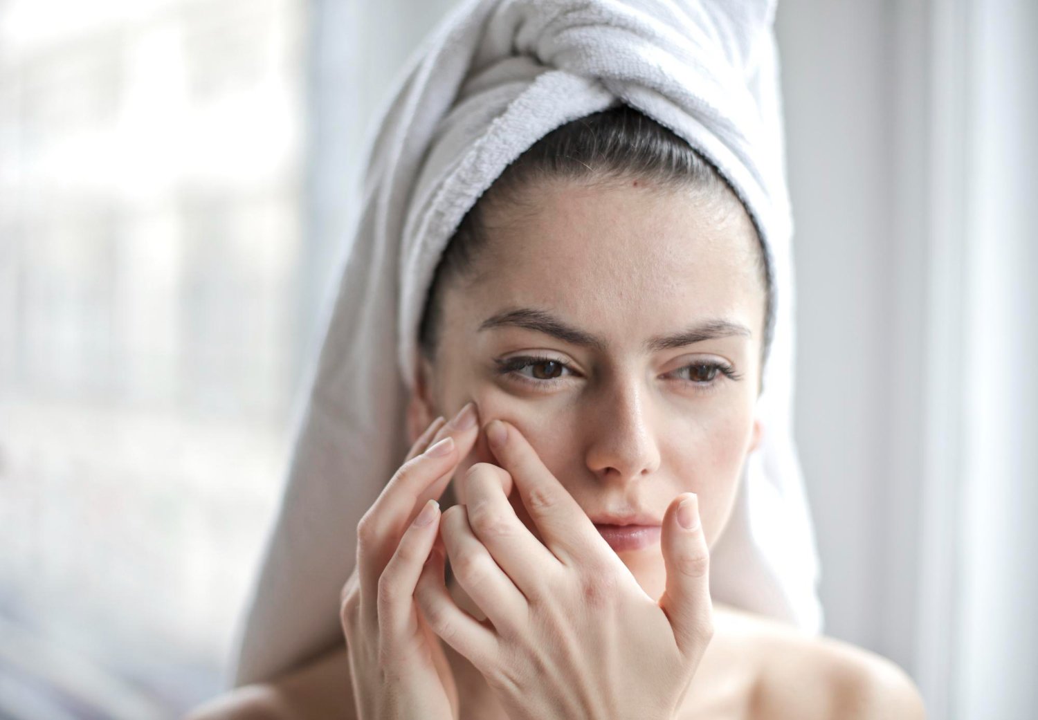 Read more about the article Say Goodbye to Acne: 10 Simple Home Remedies That Work for All Skin Types